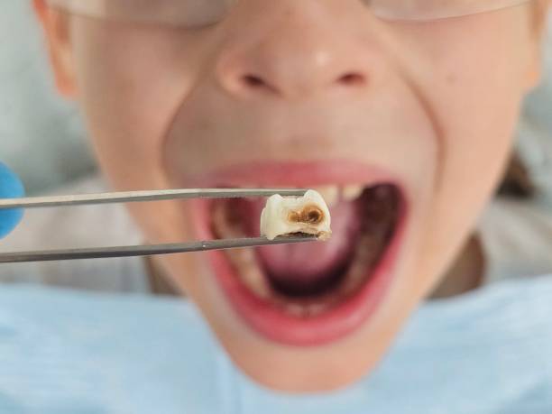 Best Emergency Pediatric Dentist  in Forks, WA